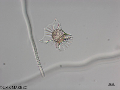 phyto/Brazilian_Nordeste/Seamounts_station60/ABRACOS2 April 2017/Ornithocercus heteroporus (old Ornithocercus sp2 -Snap-557)(copy)_thumb.jpg